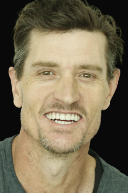 All-On-4 Dr Reza Zamani DEN0001048905