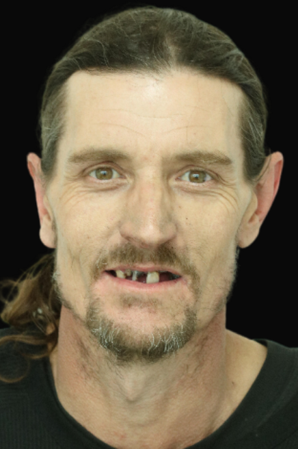 All-On-4 Dr Reza Zamani DEN0001048905