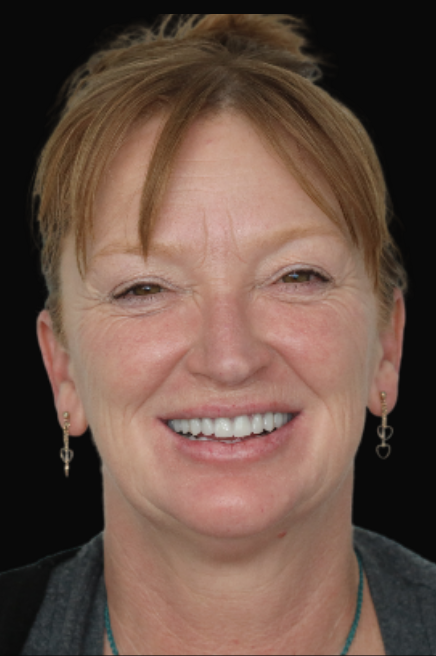 All-On-4 Dr Reza Zamani - DEN0001048905