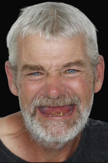 Melbourne All-On-4 Dr Reg