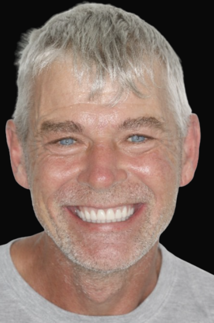 Melbourne All-On-4 Dr Reg