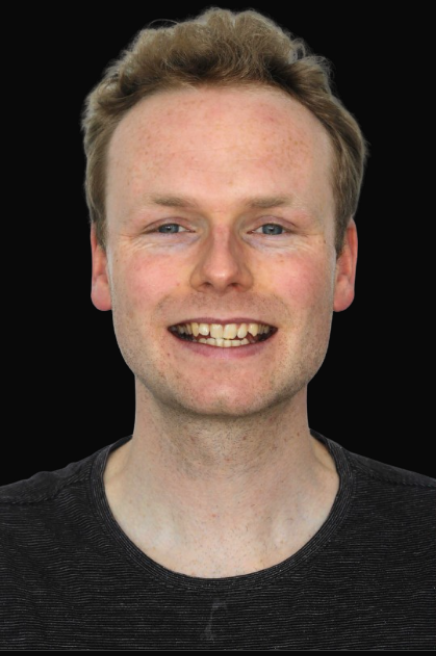 Invisalign Melbourne