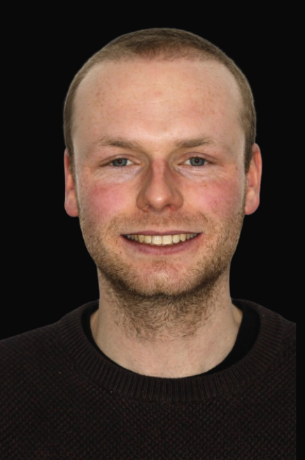 Invisalign Melbourne