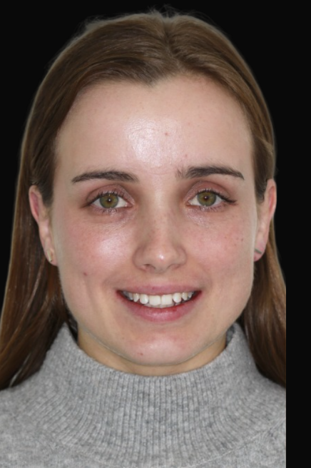 Invisalign Melbourne Dr Claudia Braybon DEN0002100548