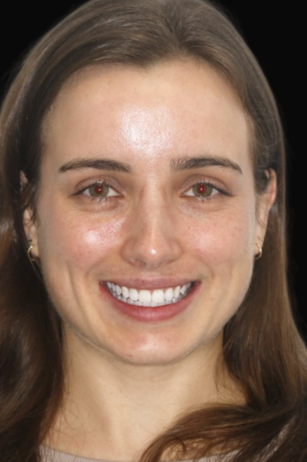 Invisalign Melbourne Dr Claudia Braybon DEN0002100548