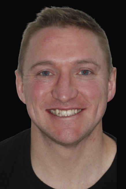 Invisalign Melbourne Dr Claudia Braybon DEN0002100548