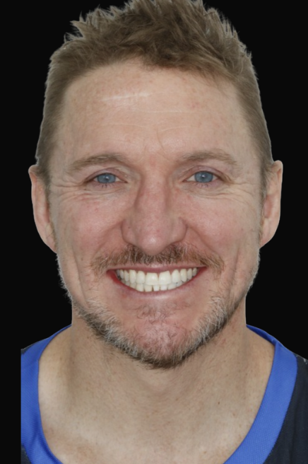 Invisalign Melbourne Dr Claudia Braybon DEN0002100548