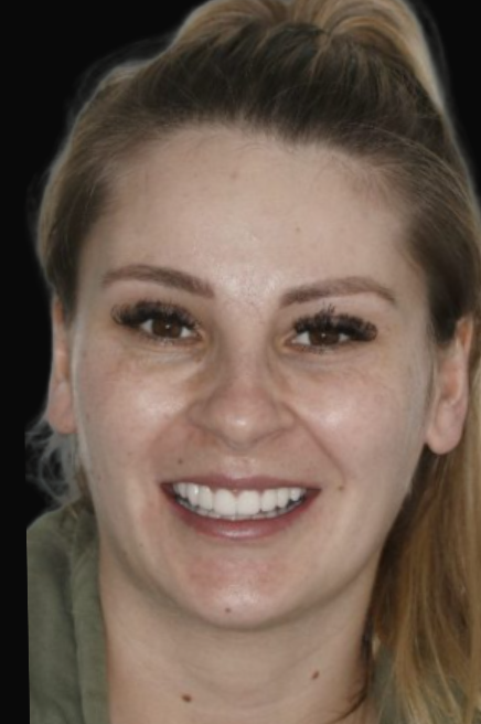 Melbourne Crowns & Bridges Dr Claudia