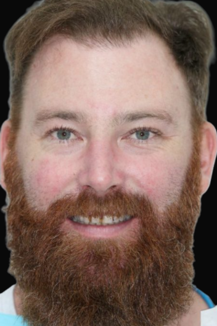 Veneers Melbourne Dr Claudia