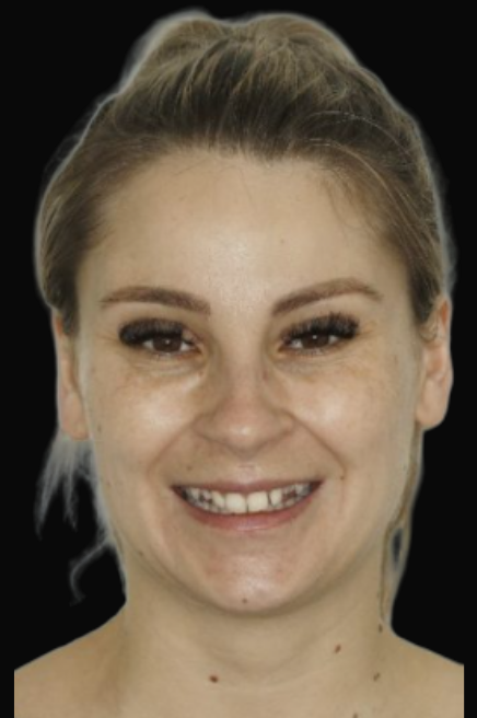 Melbourne Crowns & Bridges Dr Claudia