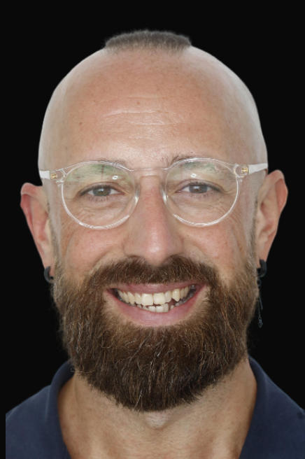 Invisalign & Composite Bonding Dr Abella Huynh DEN0002079456