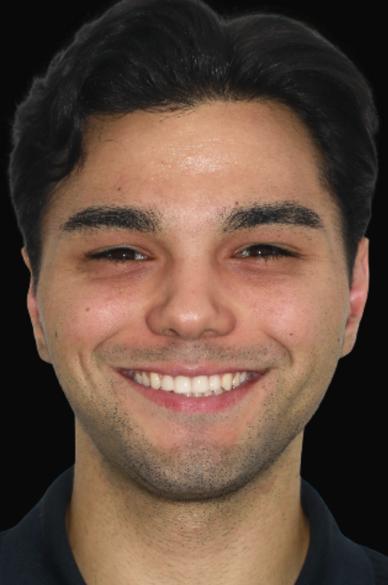 Invisalign Dr Reg De Sousa DEN0001013154