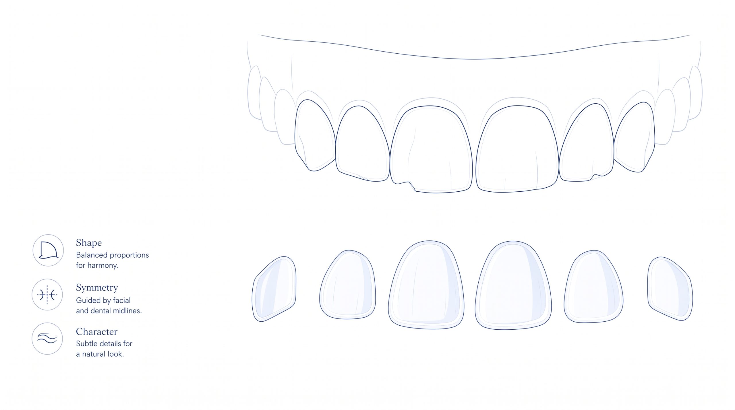 A calm planning illustration showing a simplified dental arch, thin veneer shells and subtle guidance lines arranged with generous white space.