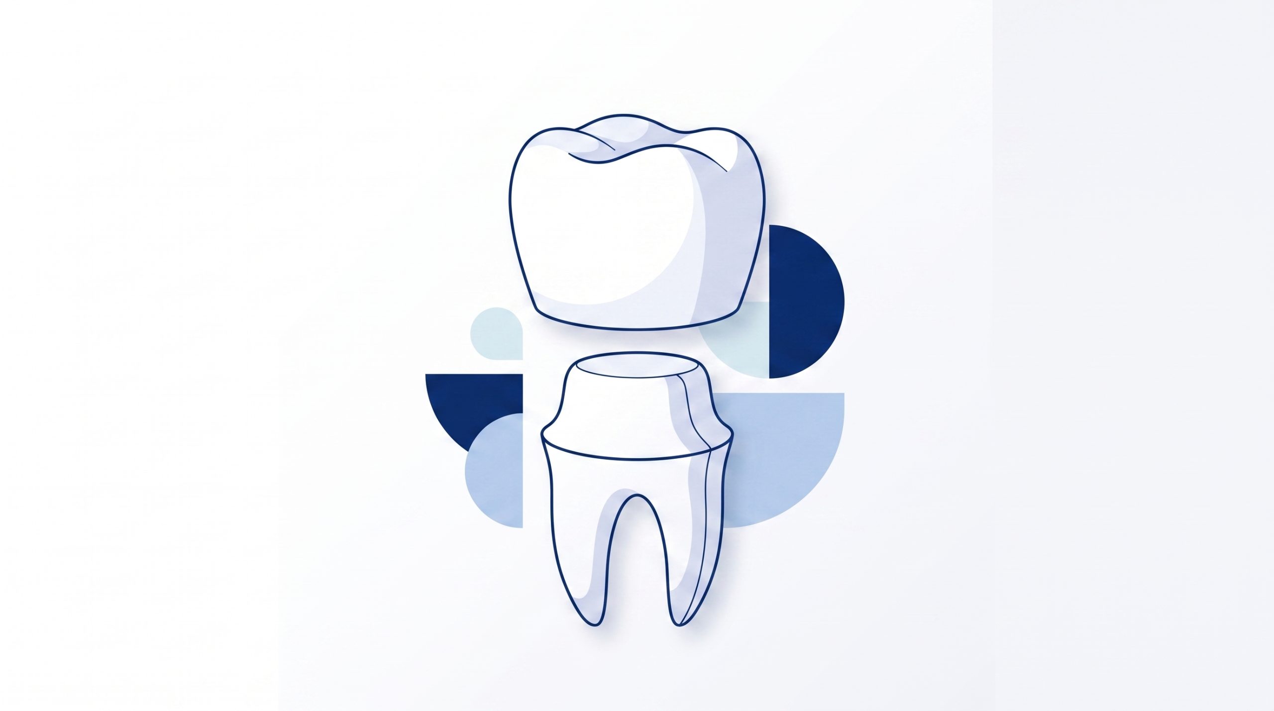 A chipped front tooth sits beside a composite repair shape and a veneer shell, showing common options for repairing a chipped tooth.