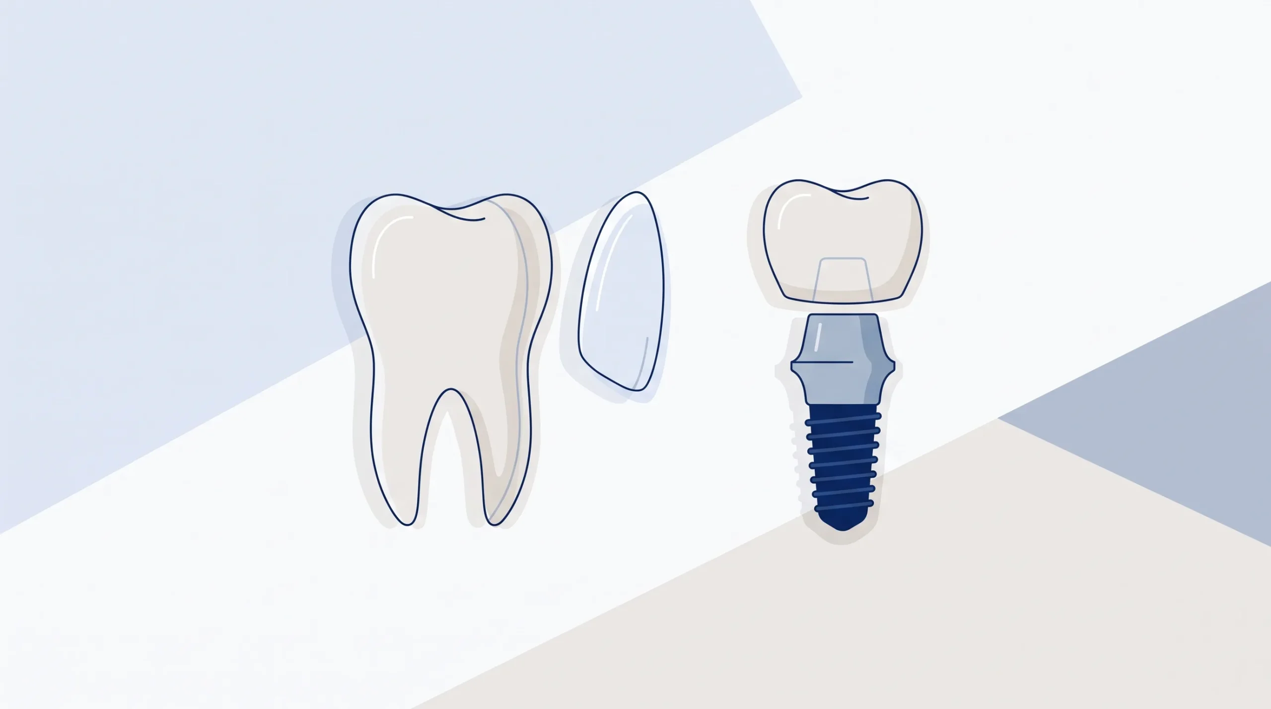 A natural front tooth, thin veneer shell and implant crown assembly are shown separately in a spacious treatment planning scene.