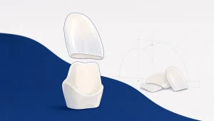 How to Choose a Cosmetic Dentist in Melbourne - Main Image